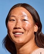 Woman with freckles