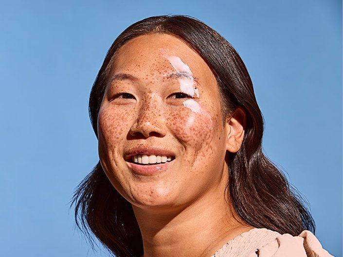 Woman with freckles